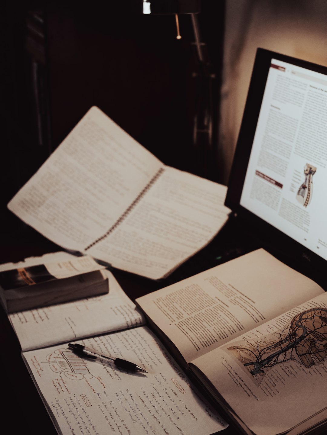Un escritorio desordenado con libros de texto y una computadora portátil que muestra anatomía.